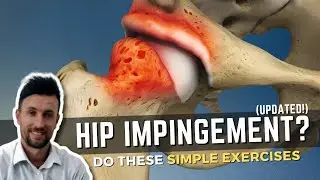 Are You Doing THESE Highly Effective Hip Impingement Exercises?