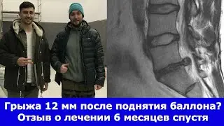 Грыжа 12 мм уменьшилась в 2 раза за 6 месяцев. Отзыв о лечении