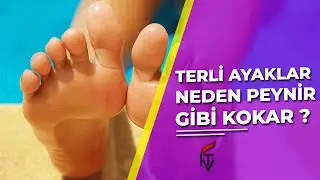 Terli Ayaklar Neden Peynir Gibi Kokar?