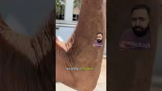Doctor Explains The Real Life Popeye!