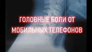 Головные боли от мобильных телефонов и других устройств