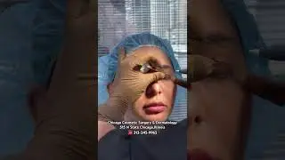 Visit ChicagoDermatology.com to learn more about us! #chicago #skincare #cosmeticdermatology #beauty