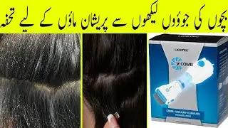 V Comb Anti lice machine Review | How to Remove Lice Permanently from Hair