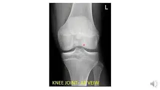 Radiological Anatomy of Lower Limb