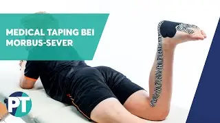 Morbus-Sever | Medical Taping | PhysioTape