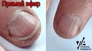 НАЛИПШАЯ КУТИКУЛА  МАНИКЮР ОНЛАЙН.  Виктория Авдеева
