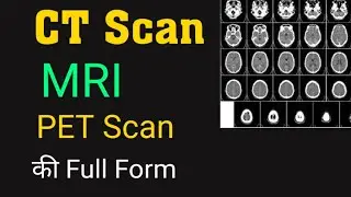 Full Form of CT Scan | Full Form of MRI | Full Form of PET Scan