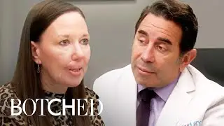 Most Devastating Medical Mishaps FIXED on Botched | E!