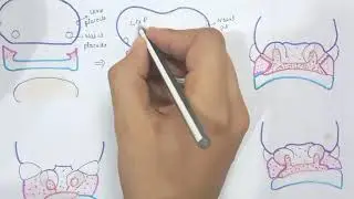 Development of face 2 - lips , cheek - continued....