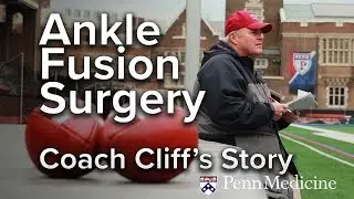 Ankle Fusion Surgery | Cliff's Story