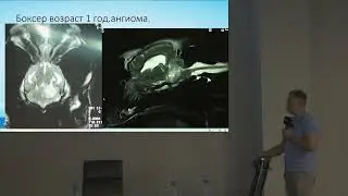 Новообразования  центральной нервной системы