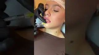 Увеличение губ. Запись на все обучающие программы ➡️ inst:dr.antonina_guz