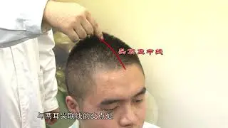 晕眩、疲惫乏力, 试试醒脑开窍的百会穴
