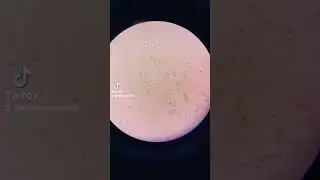 vaginal swab under the microscope 