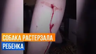 Хозяйская собака напала и растерзала ребенка