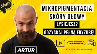 Łysiejesz? Odzyskaj pełną fryzurę dzięki Mikropigmentacji Skóry Głowy! KLINIKA SMP