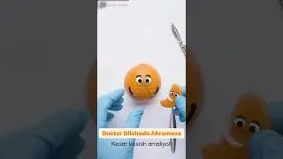 Kesir kesish amaliyoti. +998 93-654-43-30 Dilshoda Akramova