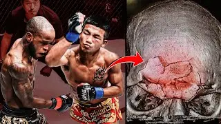 Tailandês de Aço está implodindo a ELITE do Muay Thai.. Rodtang Jitmuangnon