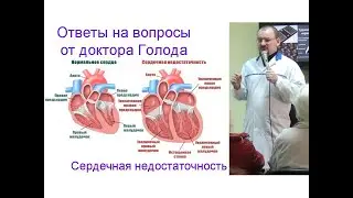 Сердечная недостаточность – ответ от доктора Голода