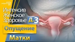 День 3. Опущение матки / Женское здоровье / Бесплатный мастер класс.