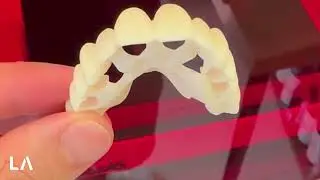 Full Arch FP1, Smile Design and Surgical Guide