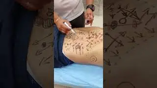 Общая схема работы в Правке живота