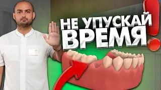 Почему важно не упускать время и не откладывать имплантацию после потери зубов?
