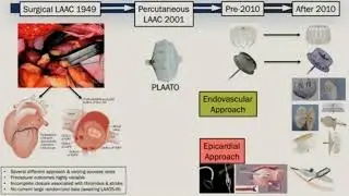 Jacqueline Saw, MD, FRCPC, FACC, FAHA, FSCAI - LAA Closure for AFib Patients