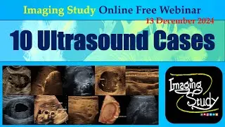 10 Ultrasound Cases || Imaging Study || 13 December 2024 || Online Webinar