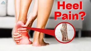 The BEST Plantar Fasciitis Rehab Exercises and Treatments!