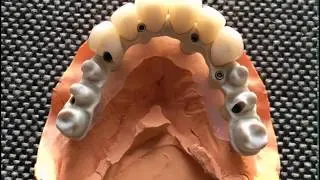 Vsmile PEEK Material