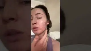 Чистое лицо