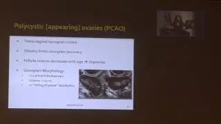 Polycystic Ovarian Syndrome (PCOS)