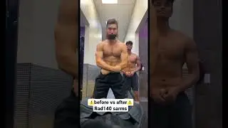 T drop is the #1 complication of sarms… think about that