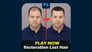 Restoration Lost Hair!  🤯😎 