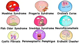 Every Rare Disease Explained in 14 Minutes