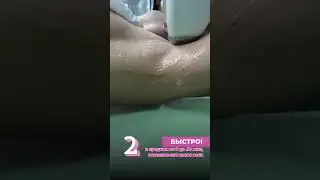 7 причин влюбиться в лазерную эпиляцию ❤ 