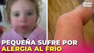 Madre sufre por la extraña alergia de su hija