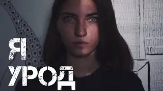 Я УРОД