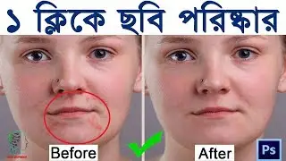 How to Remove Acne And Skin Smooth In Photoshop CS6 or CC