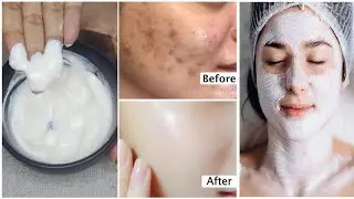 Best Homemade Facial for Skin Whitening  Natural Glow & Brightening Remedy