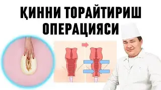 ҚИННИ ТОРАЙТИРИШ ОПЕРАЦИЯСИ САЛБИЙ ВА ИЖОБИЙ ТОМОНЛАРИ / ВАГИНОПЛАСТИКА  ЖАРАЁНИ ҚАНДАЙ ҚИЛИНИШИ