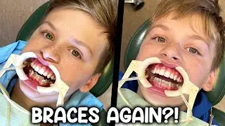 Zac & Chris Get Braces!