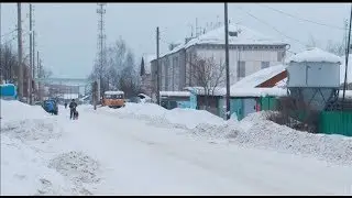 В Боровском собака покусала двухлетнего ребёнка
