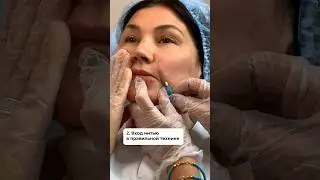 Как поставить нити метелки