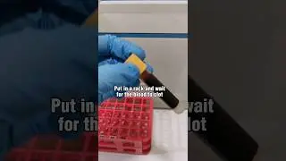 how do we get blood serum? 