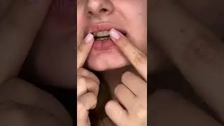 Отбеливаю зубы дома🔥 wb - 154699612