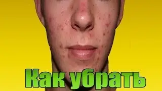 [Урок] Как убрать прыщи, родинки и д.р в Photoshop