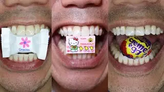 You Won’t Be Able to Stop Watching This Chocolate and Candy Chewing Doctor Tristan Peh ASMR