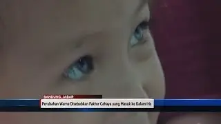 Seorang Gadis Cilik Punya Empat Warna Mata ’Apa Kata Dokter Mata?’ – NET YOGYA